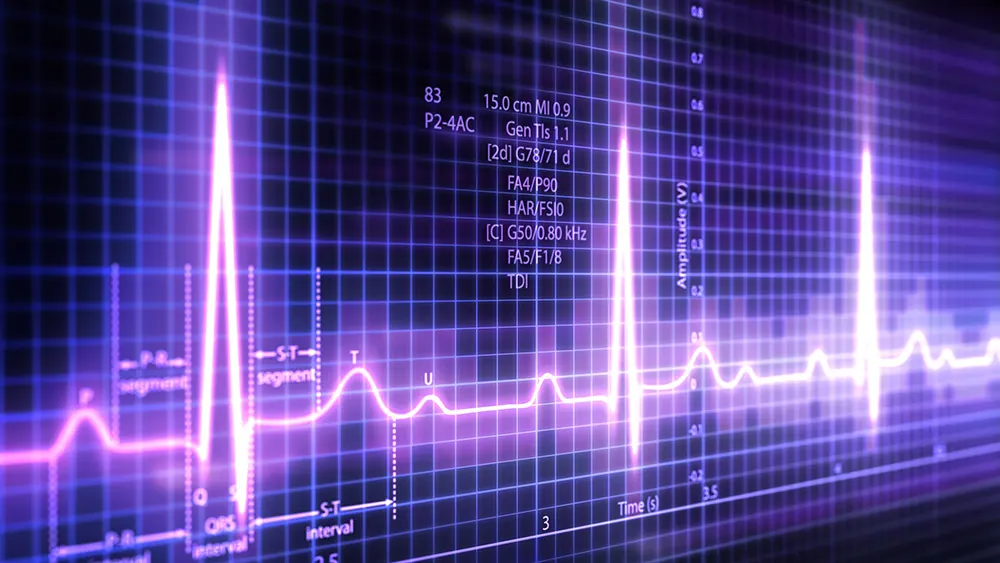 EKG Aufzeichnung
