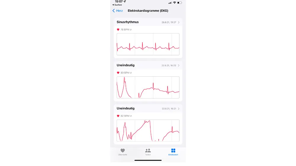 EKG Aufzeichnung