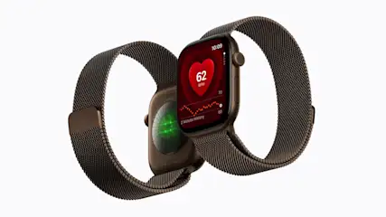 Zwei Apple-Watch-Series-12-Smartwatches nebeneinander, eine schräg von vorne, eine schräg von hinten.