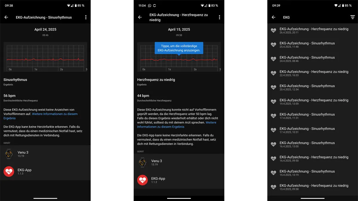 Drei Screenshots zeigen EKG-Aufzeichnungen mit der Garmin Venu 3 an.