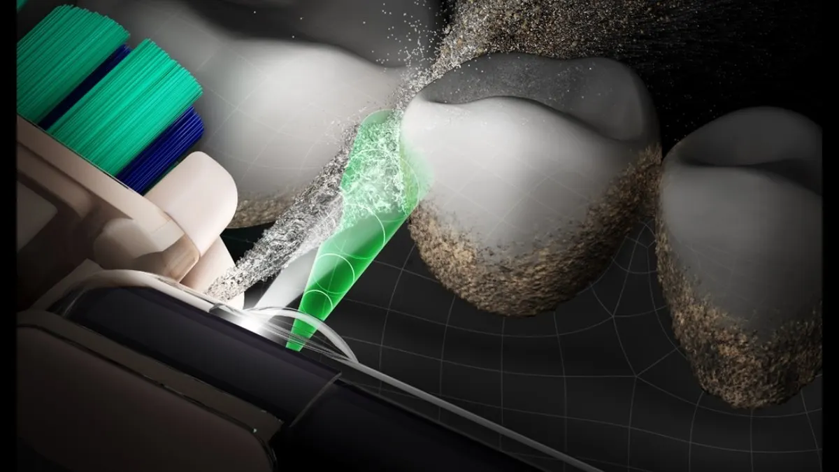 Eine Grafik simuliert, wie die Kamera der Dyson CameraJet einen Zahnzwischenraum erfasst reinigt.