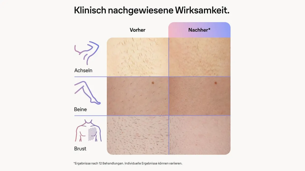 Bildbeschreibung ist nicht vorhanden