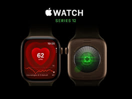 Apple Watch Series 12