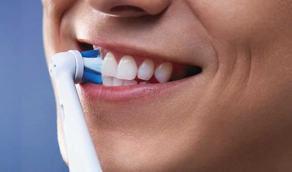 Een close-up toont een glimlachend gezicht terwijl een elektrische tandenborstel met blauwe haren zorgvuldig de witte voortanden poetst.