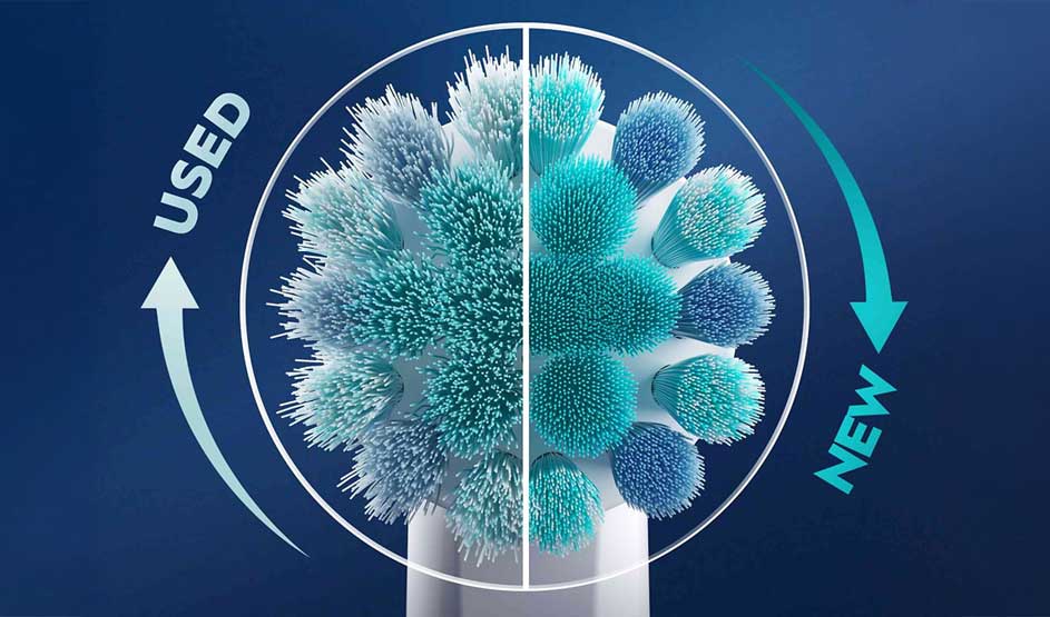 Vergelijking tussen gebruikte en nieuwe tandenborstelkop met turquoise borstelharen op blauwe achtergrond.