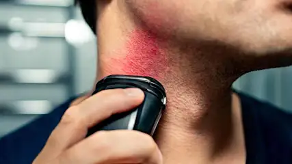 Een man scheert zijn hals met een zwart elektrisch scheerapparaat. De huid is rood. Achtergrond is een wazige grijze muur.