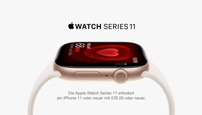 Abbildung Apple Watch Series 11. Text: Die Apple Watch Series 11 erfordert ein Phone 11 oder neuer mit iOS 26 oder neuer.