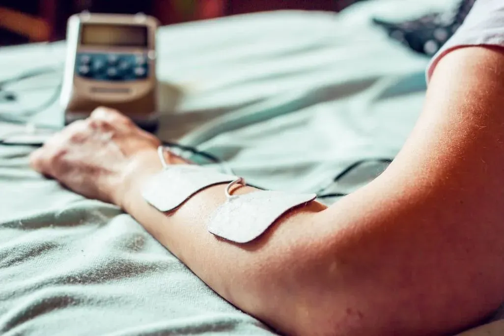  Arm mit aufgelegten Elektrodenpads, die über Kabel mit einem kleinen Reizstromgerät im Hintergrund verbunden sind.