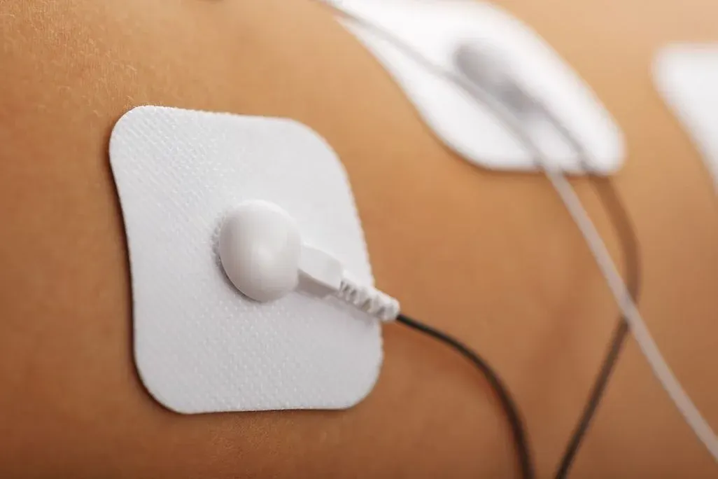 Nahaufnahme eines weißen Elektrodenpads auf der Haut, an das ein Kabel für die elektrische Stimulation angeschlossen ist.